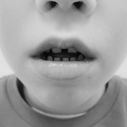 Fotos orofacial (3) Fotos orofacial (3)