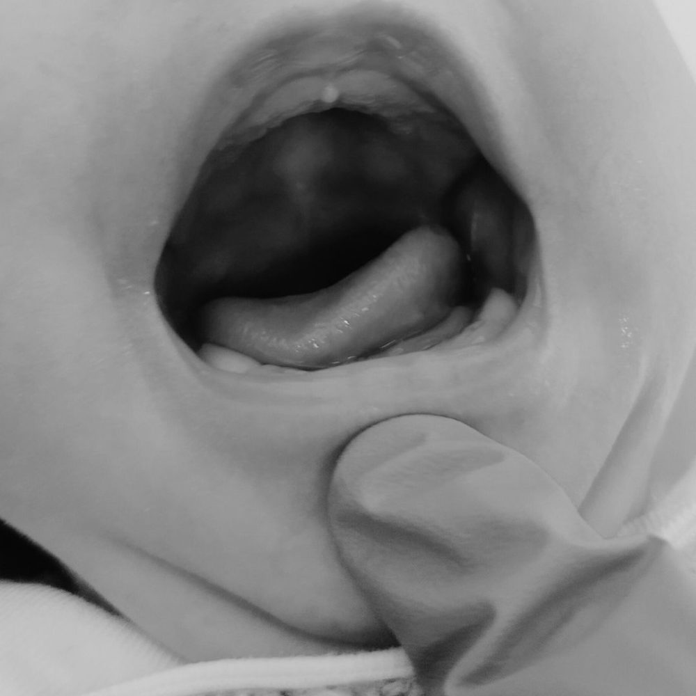 Fotos orofacial (4)